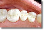 cosmetic dentist in santa monica 